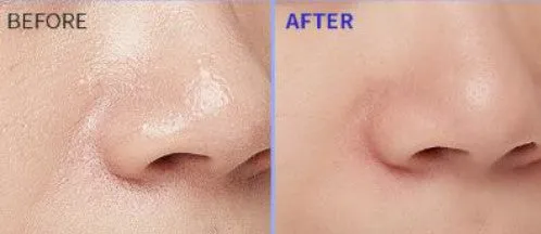 APIEU Deep Clean Foam Cleanser Pore 130ml